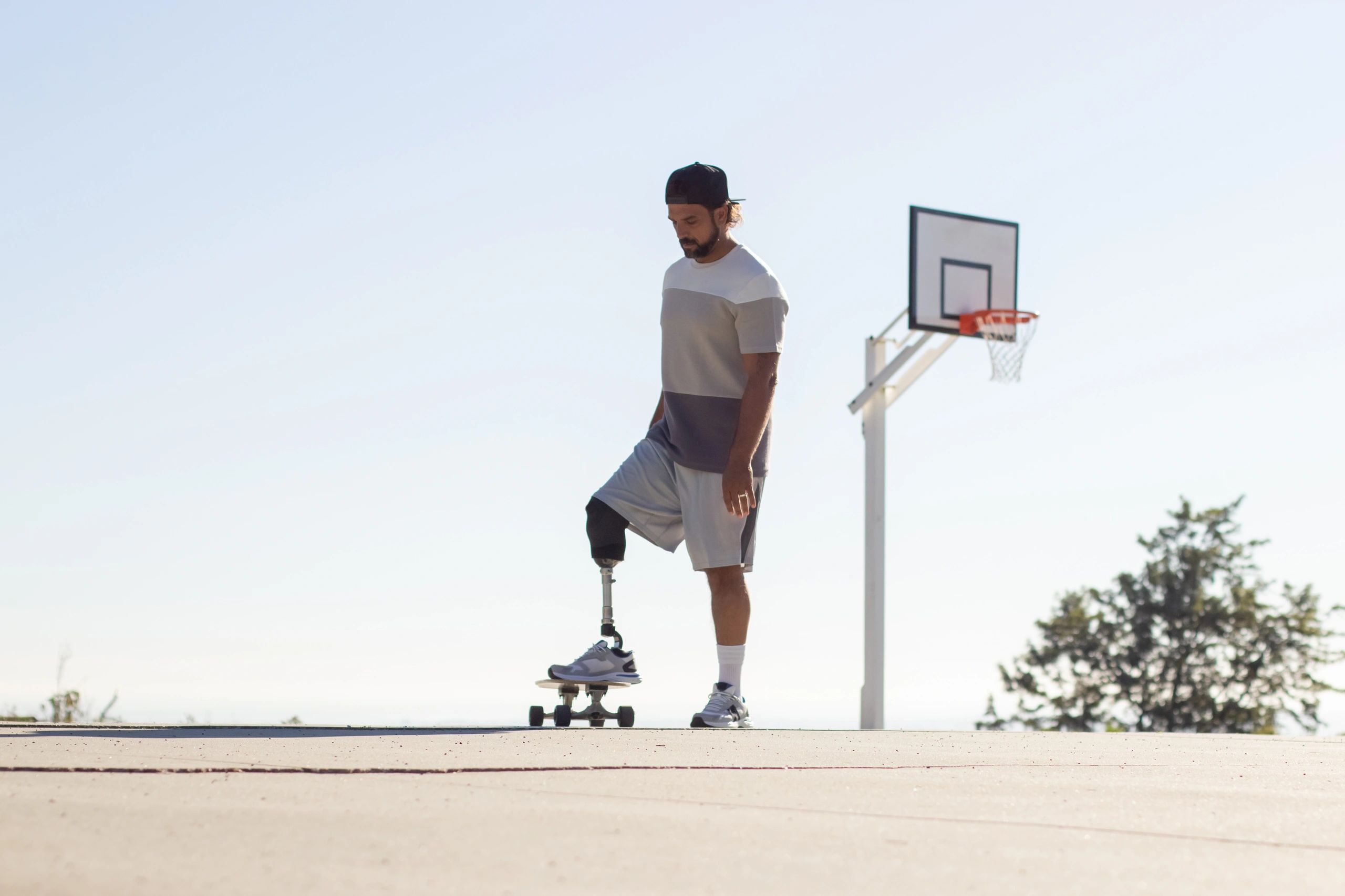 Upper limb and cosmetic prosthetic restoration Delhi NCR