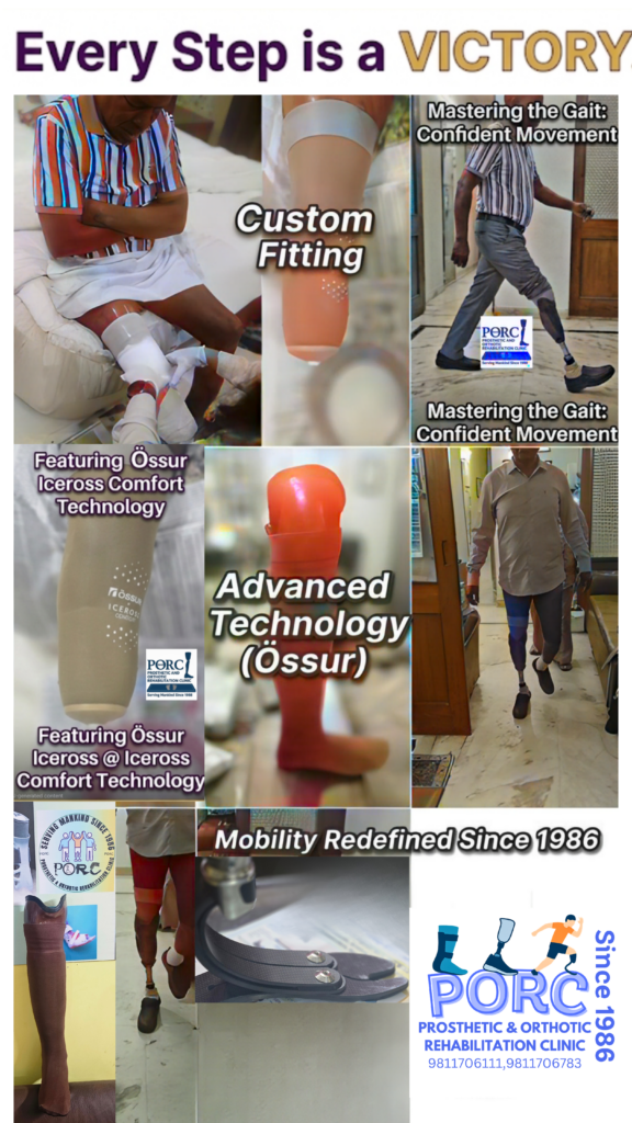 Orthotic braces and Ossur supports Delhi NCR
