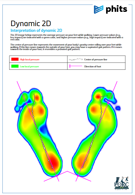 PHITS Dynamic 2D foot pressure scan showing plantar pressure and centre of pressure lines